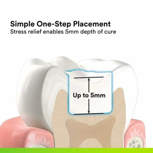 Close-up diagram of a tooth showing 5mm depth of cure for 3M ESPE Bulkfil dental capsules simple one-step placement