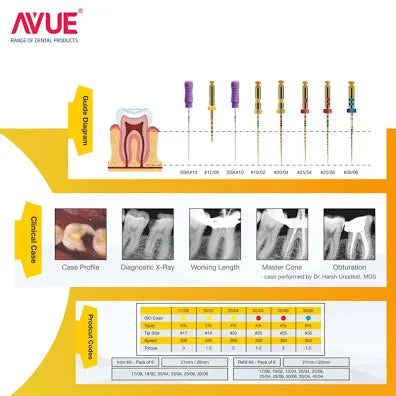 Avue Aurum rotary files guide diagram showing file sizes and clinical case examples by Beetle Dental
