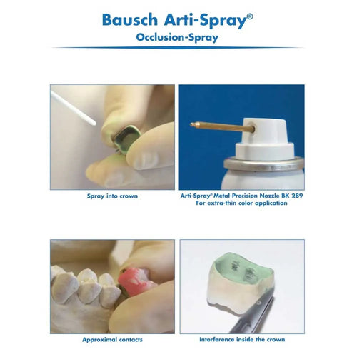 Bausch Arti-Spray BK 289 for dentists occlusion spray showing spray nozzle, crown application, and dental mold details