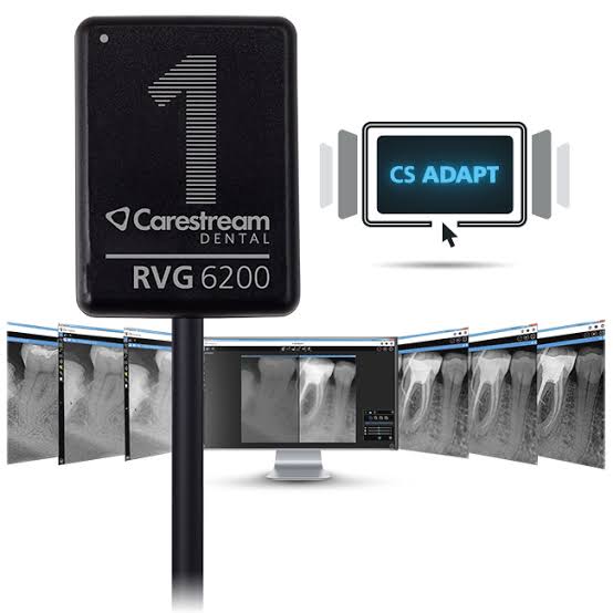 Carestream CS6200 RVG sensor for dental imaging showcased with compatible software on multiple screens