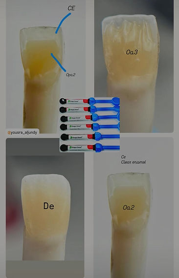 Dengen Supreme Pro Composite resin shade samples on tooth models with applicator syringes by Beetle Dental