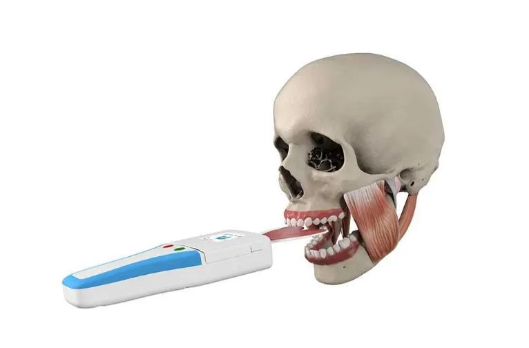 Bausch Occlusense Set - BK 5000 electronic occlusion sensor inserted in anatomical skull model for bite analysis