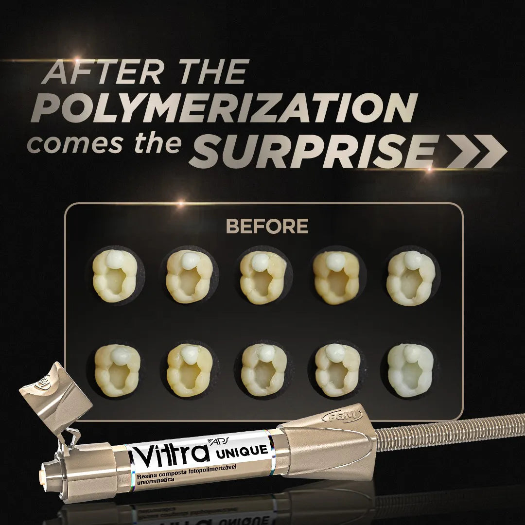 Beetle Dental syringe and set of polymerized tooth samples showcasing color change FGM Vittra APS Unique dental composite