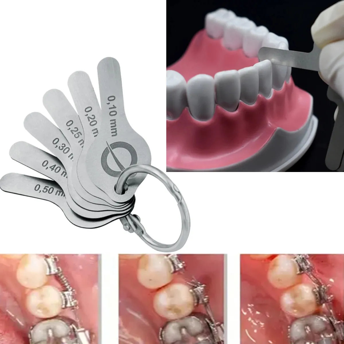 Beetle Dental interproximal space gauge set for measuring gaps between teeth with precision