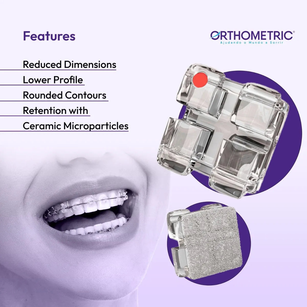 Beetle Dental monocrystalline ceramic dental brackets featuring reduced dimensions and rounded contours