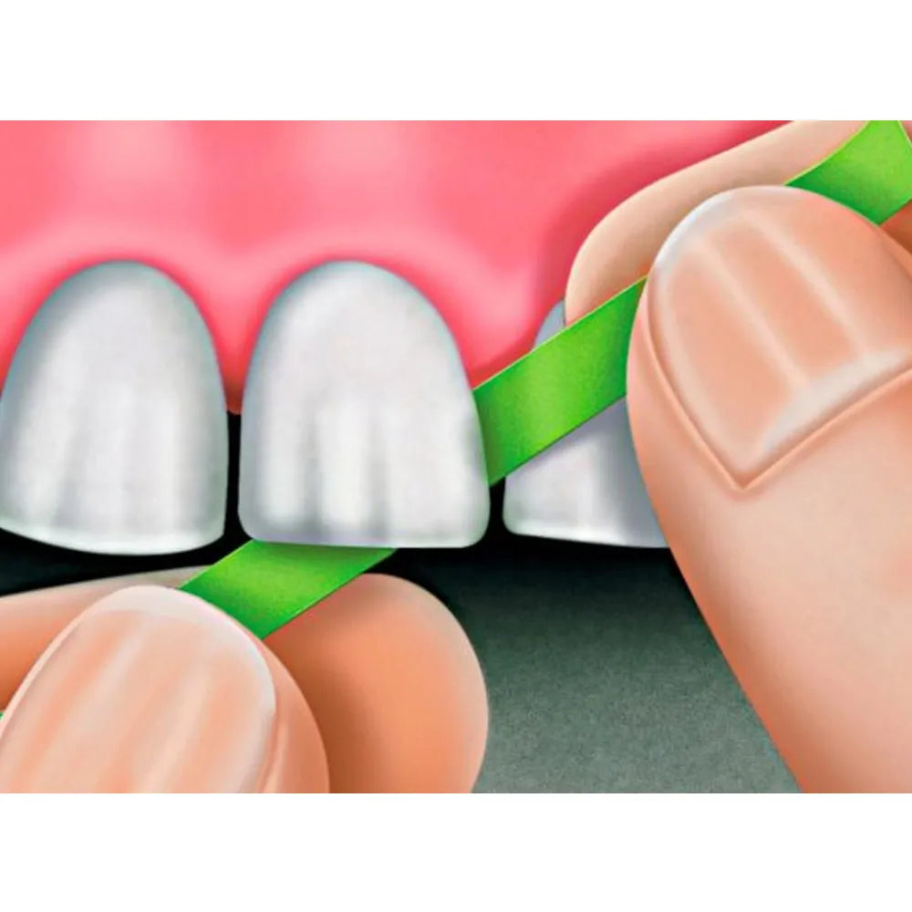 Close up of fingers polishing front teeth with Polydentia abrasive polishing strips for interproximal smoothing