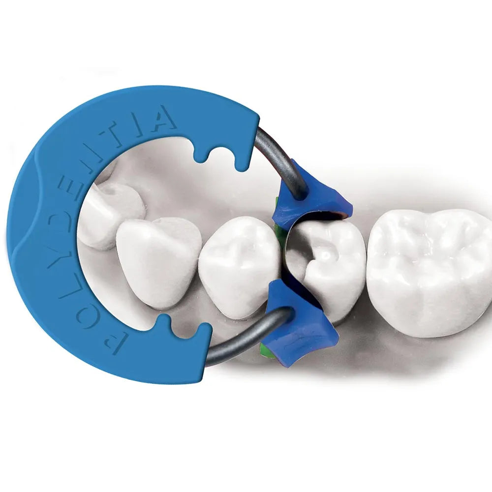 Polydentia MyQuickmat Classico sectional matrix kit on molars with blue ring metal matrices and green wedges for tight contacts