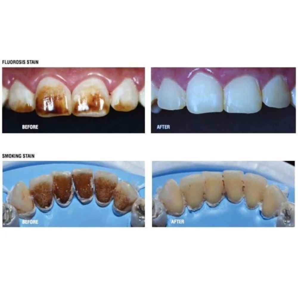 MDC Dental Antivet kit