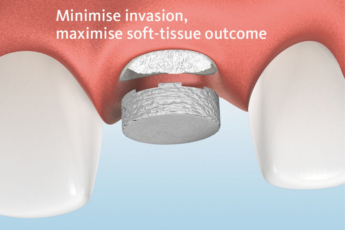 Geistlich Mucograft Seal Collagen Matrix