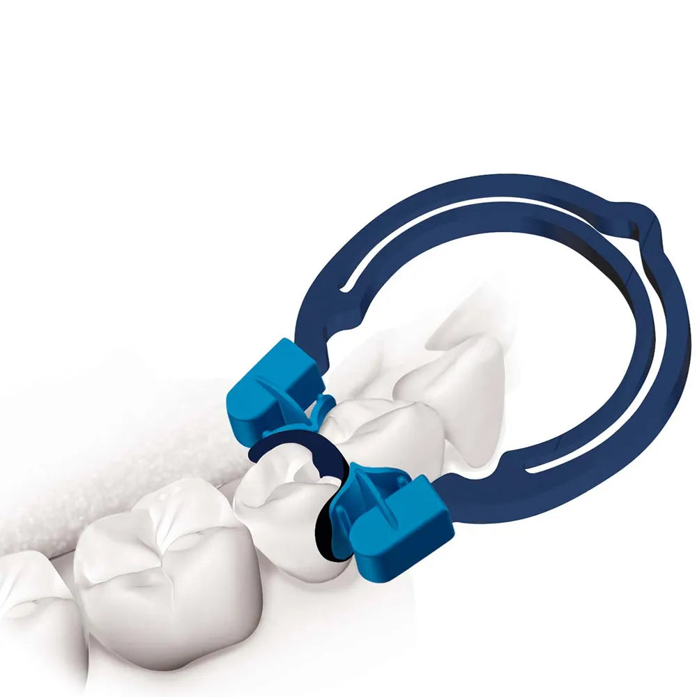 Polydentia MyQuickmat Forte sectional matrix system kit showing blue sectional ring and wedges on molar