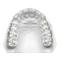 Clear upper dental vacuum formed tray on model made with Scheu Durasoft Pre Dried dental sheets for aligners