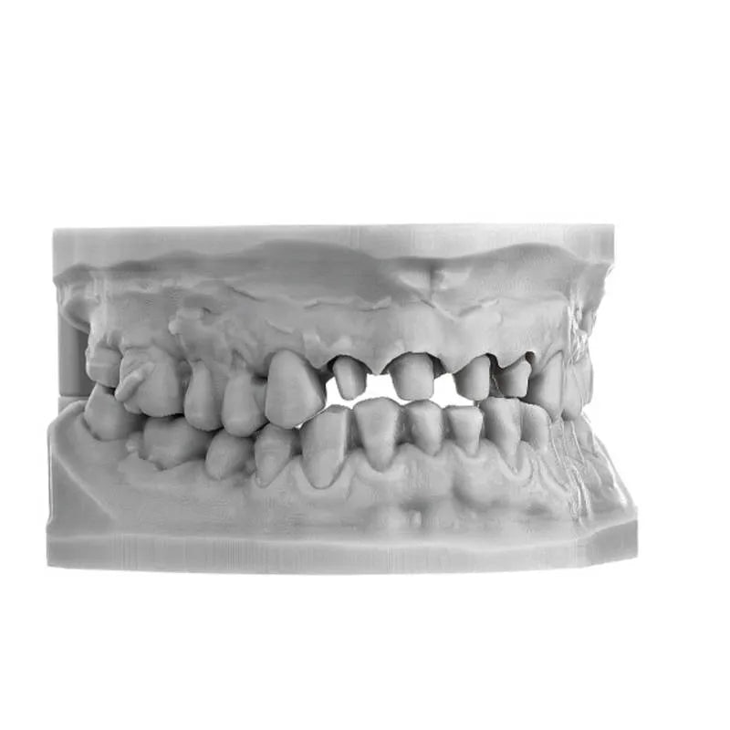 Scheu Imprimo LC dental 3D printing resin printed full arch occlusion model showing detailed teeth anatomy