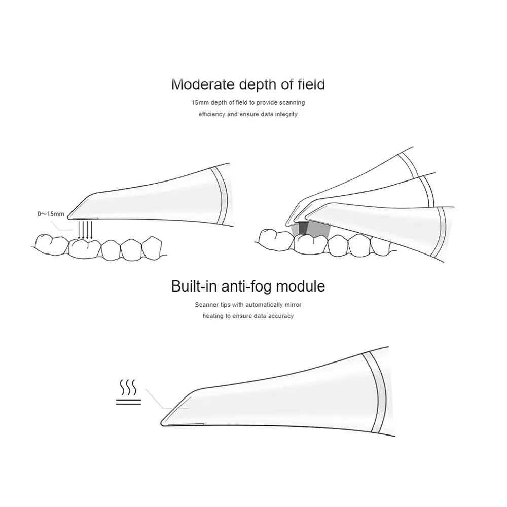 Detailed illustration of Upcera FLNTScan R1 intraoral scanner features for optimal dental scanning