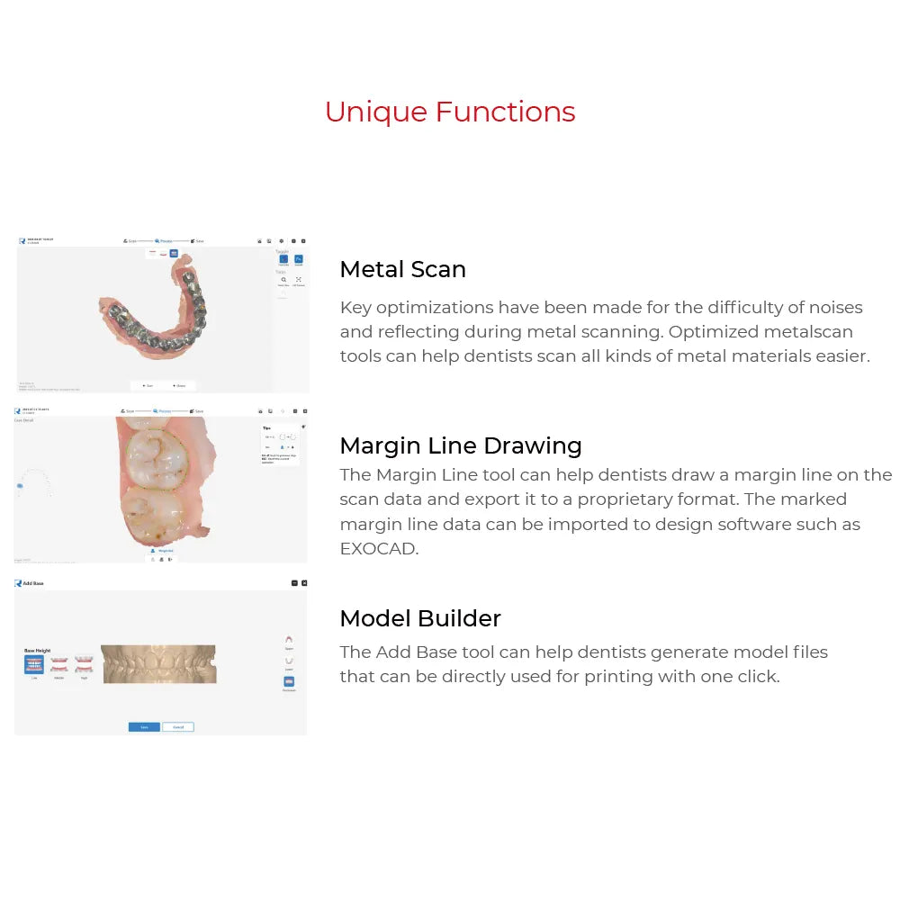 Upcera FLNTScan R1 intraoral scanner interface showing metal scan, margin line drawing, and model builder features
