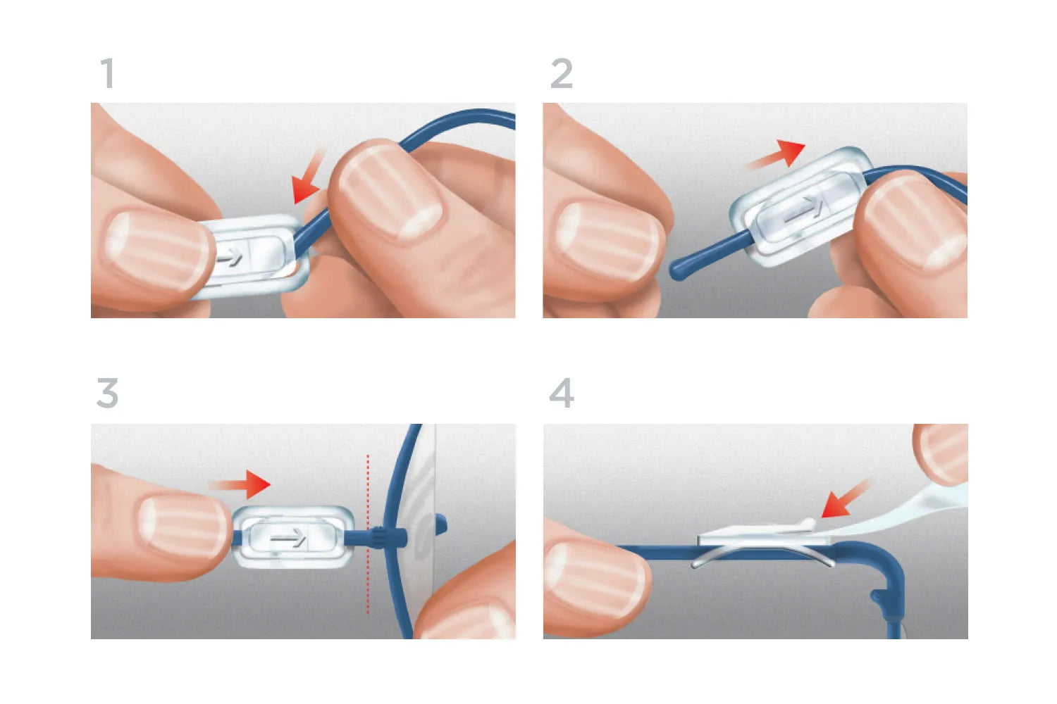 Beetle Dental Vista-Tec Clipon face shield assembly instructions showing hands clipping clear plastic latch onto blue frame