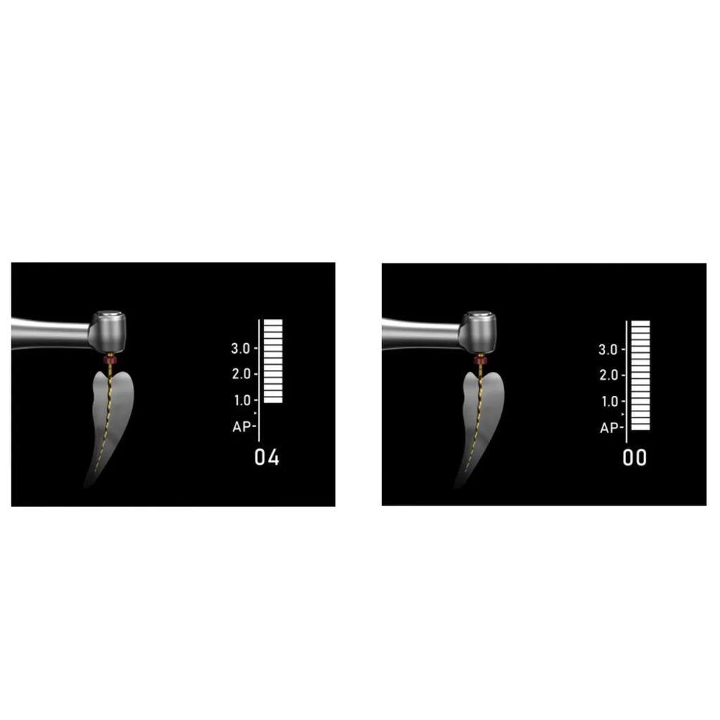 Woodpecker Endopace Pro Endomotor showing dual display apex locator simulation with endodontic file in root canal