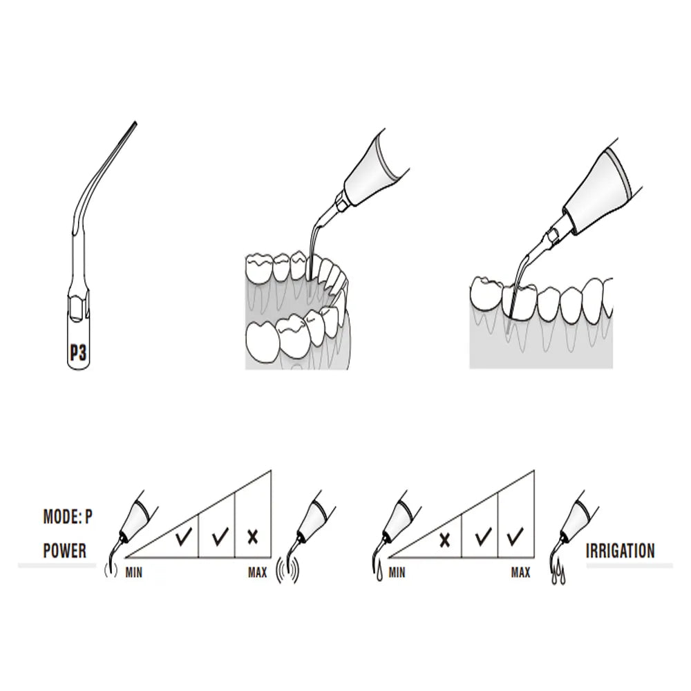 Woodpecker Scaler Tip P3 diagram showing scaler tip intraoral use on teeth power and irrigation guides